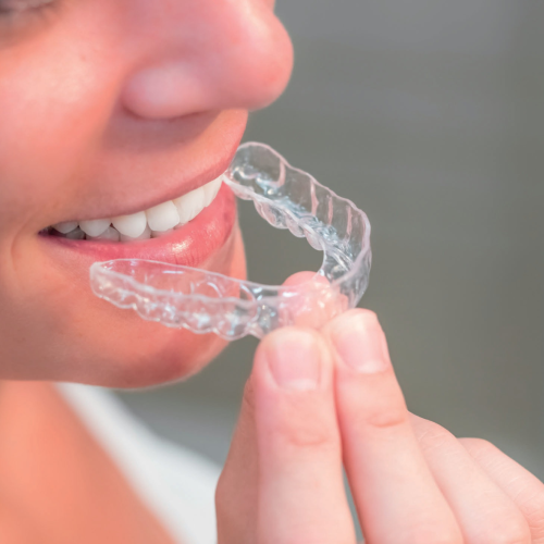 INVISALIGN